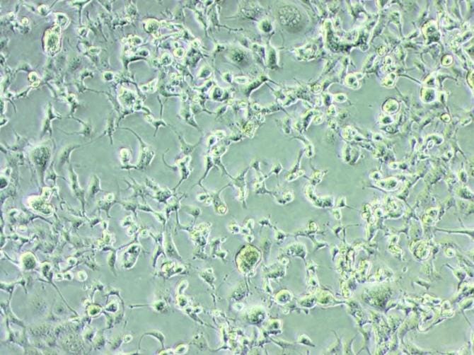 Covid, isolata in Puglia la variante Omicron del coronavirus