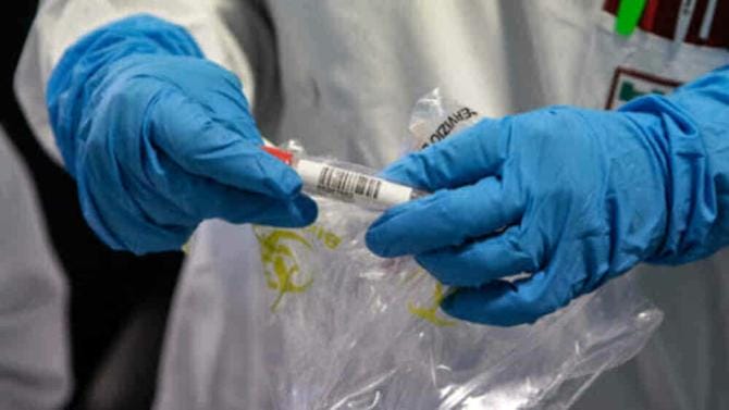 Covid, in Basilicata 611 nuovi positivi e tre decessi
