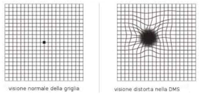 Giornata di prevenzione oculistica APAM
