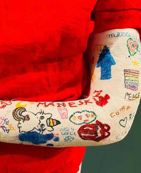 Simboli e messaggi di pace sui gessi dei bimbi del reparto di ortopedia del Giovanni XXIII di Bari