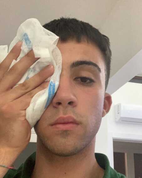 Mesagne, giovane cestista colpito al volto da tifoso avversario al termine di una partita di basket a Bitonto