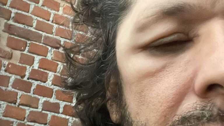 Ermal Meta, «Mi si gonfia la testa, sono costretto ad annullare l’intervento a Peschici»