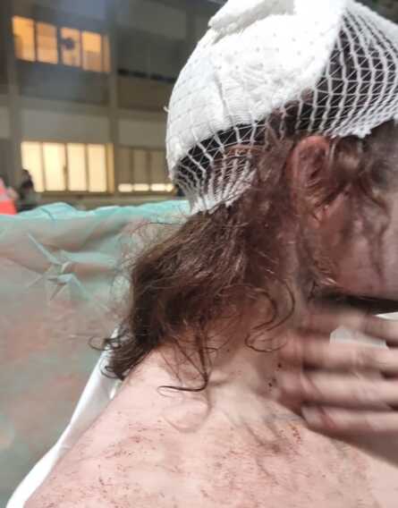 Aggressione omofoba a Parco Rossani dopo il Pride: «Non resterà impunita»