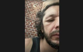 Galleria foto 'Ermal Meta annulla concerti: “Ma non sto morendo…”' - foto 1