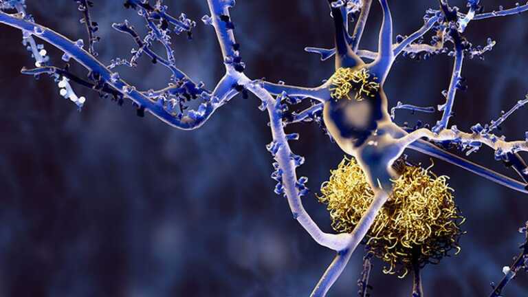 Galleria foto 'Alzheimer, Roche conferma il suo impegno in ricerca e sviluppo' - foto 1