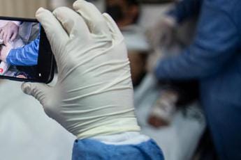 Galleria foto 'Vaiolo scimmie, virus nei testicoli: “Ipotesi trasmissione sessuale”' - foto 1