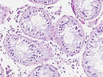Galleria foto 'Tumori, Mantovani: “Dati incoraggianti da vaccini a mRna”' - foto 1