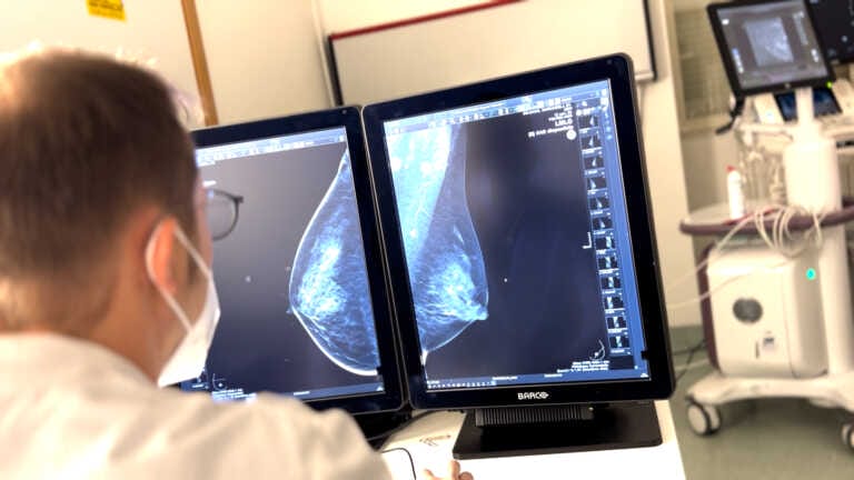 Intelligenza artificiale per diagnosi precoci del tumore al seno: l’innovativo software al Policlinico di Bari – VIDEO