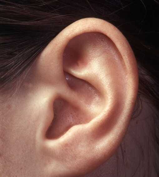 Galleria foto 'World Hearing Day, nel mondo 1 persona su 5 soffre di un calo dell’udito' - foto 1