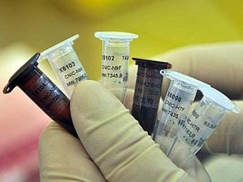 Galleria foto 'Aviaria, un caso umano di H5N1 in Cina' - foto 1