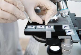 Galleria foto 'Malattie neurodegenerative, arriva dispositivo nanotech tutto made in Italy' - foto 1