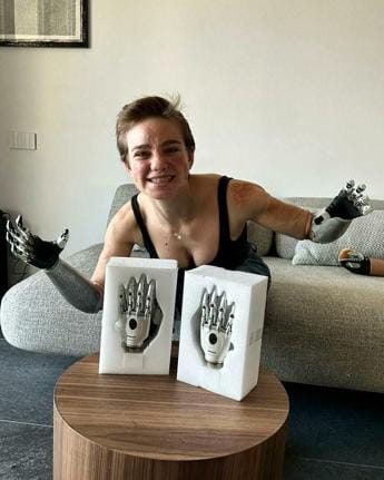 Galleria foto 'Scherma: Bebe Vio presenta le sue nuove mani bioniche, ‘non vedo l’ora di fare tutti i gesti’' - foto 1
