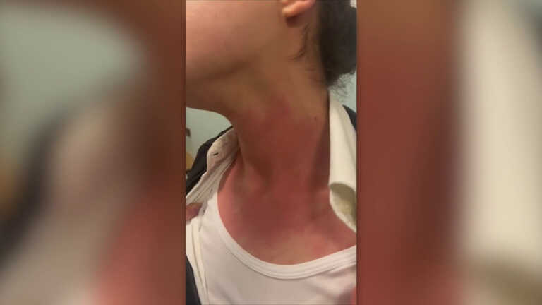 Galleria foto 'Norme più dure contro la violenza negli ospedali' - foto 1