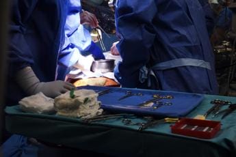 Trapiantato cuore fermo da 20 minuti, prima mondiale a Padova