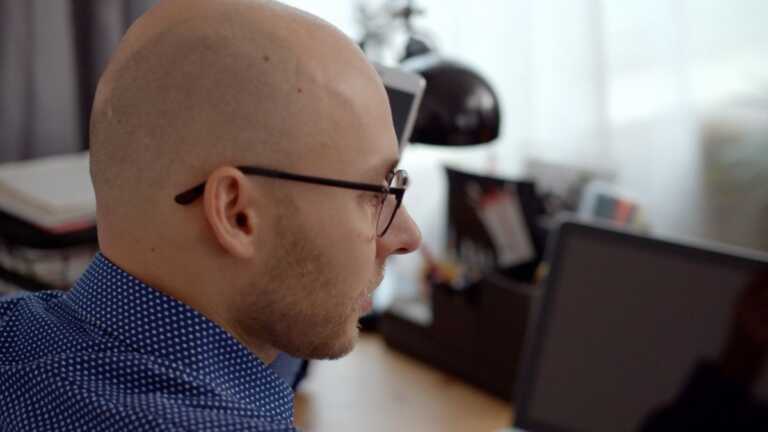 Galleria foto 'Alopecia, in Italia colpisce 4 uomini su 10. Il trapianto una soluzione' - foto 1