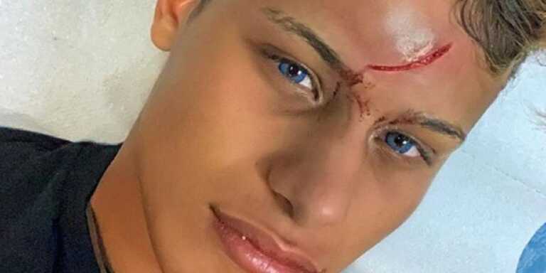 Influencer ferito in un locale a Mykonos: 27enne barese assolto “per non aver commesso il fatto”