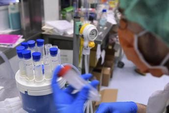 Galleria foto 'Farmaci, Ucb: nuovi dati bimekizumab in artrite psoriasica e spondiloartrite assiale' - foto 1