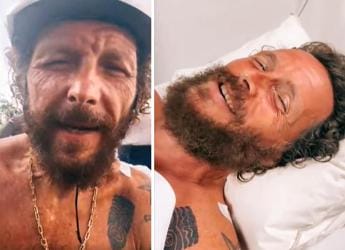 Galleria foto 'Incidente per Jovanotti, femore rotto e frattura alla clavicola' - foto 1