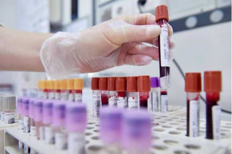 Boom di epatiti e Hiv in Puglia. E tra i giovani torna la sifilide: «Emerge dalle donazioni di sangue»