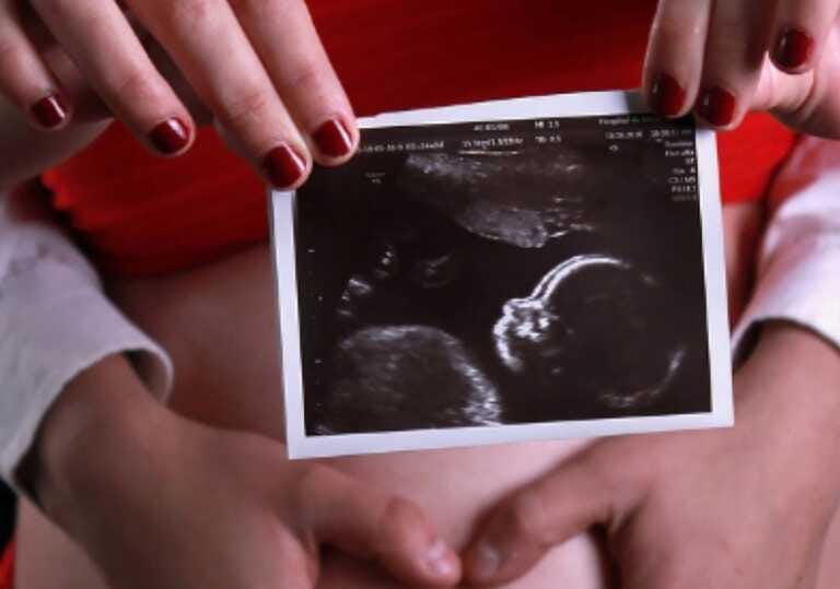 L’aborto e il disagio della donna