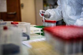 Nuova influenza suina, primo caso nell’uomo