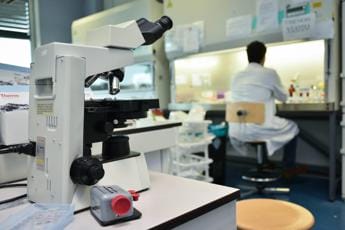 Galleria foto 'Tumore pancreas, svelato un meccanismo della malattia: lo studio italiano assist per cure' - foto 1