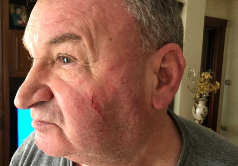 Aggredito da un ex iscritto al suo sindacato a Manfredonia: «Picchiato violentemente»