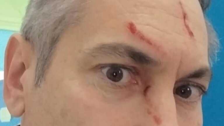 Aggredito dal padre di un’alunna, il dirigente: «Un energumeno mi ha bloccato e spinto a terra»