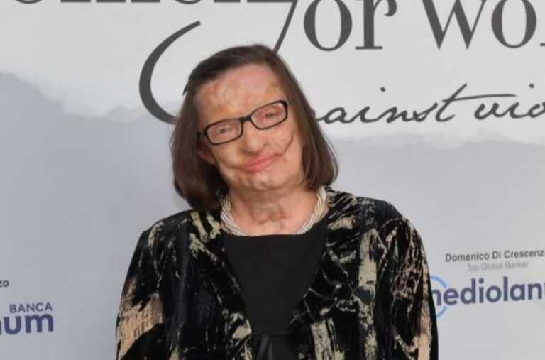 Sfregiata dal marito, Filomena Lamberti si racconta: «Sono diventata più forte dell’acido»