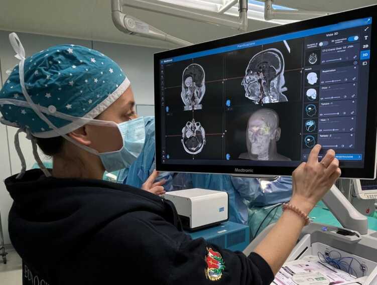 Bari, al Policlinico due nuovi neuronavigatori per il trattamento dei tumori cerebrali