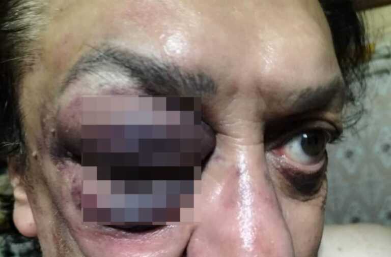 Aggressione omofoba a San Giovanni Rotondo: 57enne picchiato da 2 ragazzini