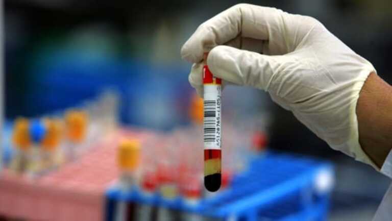 Epatite C, in Puglia un piano per l’eradicazione del virus: via ai test rapidi in farmacia