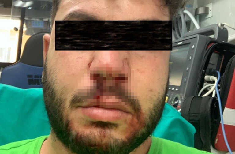 Palagiano, operaio del servizio raccolta rifiuti aggredito da un cittadino: «Ti taglio la testa»