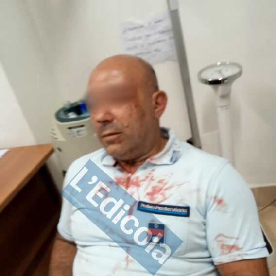 Bari, domata la rivolta nel carcere: negli scontri sequestrato un infermiere e ferito un agente – FOTO e VIDEO Bari, domata la rivolta nel carcere: negli scontri sequestrato un infermiere e ferito un agente – FOTO e VIDEO