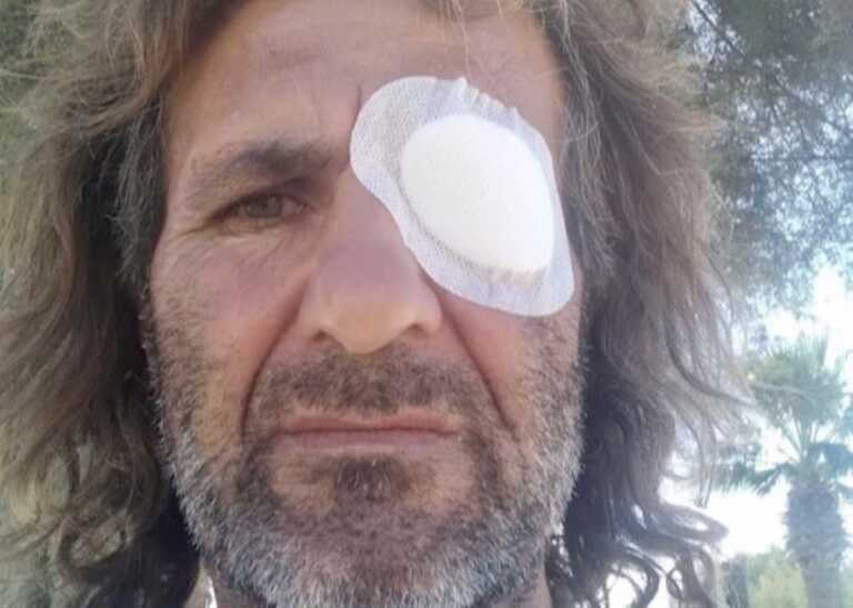 Barletta, sparano ai passanti con una pistola a pallini e condividono la scena sui social