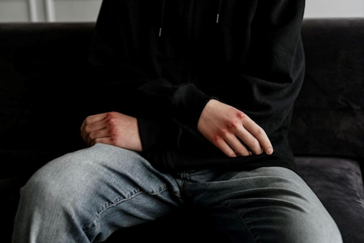 Barletta, preso di mira e picchiato da un gruppo di coetanei: ancora violenza fra i giovani Barletta, preso di mira e picchiato da un gruppo di coetanei: ancora violenza fra i giovani