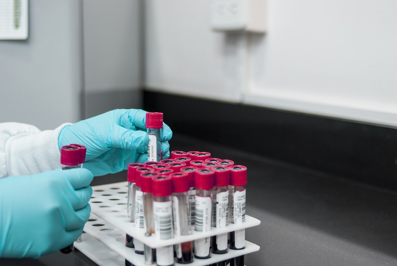 Virus Hmpv, l’Esecutivo Ue: «Monitoriamo situazione ma niente nuova pandemia» Virus Hmpv, l’Esecutivo Ue: «Monitoriamo situazione ma niente nuova pandemia»