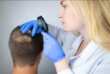 Regione Puglia, fino a 300 euro per l’acquisto di parrucche ai malati oncologici e affetti da alopecia