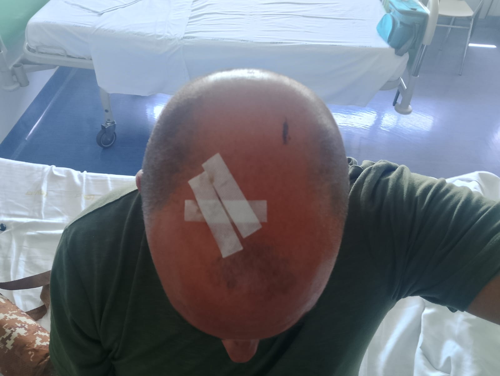 Galleria foto 'Gallipoli, si staccano piastrelle dalla parete del bagno di una camera dell’ospedale: ferito un paziente' - foto 1