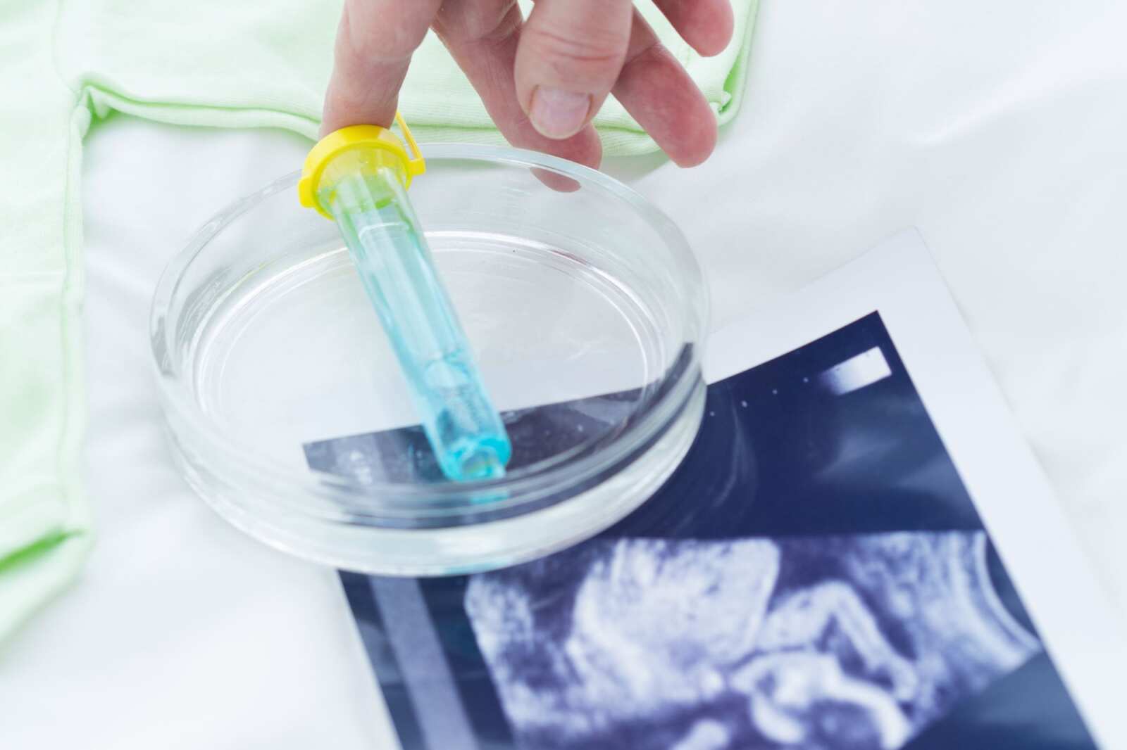 Galleria foto 'In Puglia la procreazione medicalmente assistita è un diritto garantito: sarà rimborsata dal sistema sanitario regionale – VIDEO' - foto 1