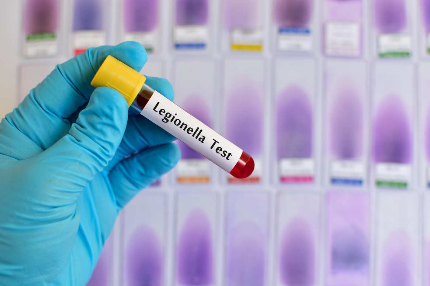 Lotta alla legionella nel Barese, via al piano per prevenire l’infezione in Rsa e b&b Lotta alla legionella nel Barese, via al piano per prevenire l’infezione in Rsa e b&b