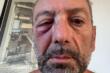 Runner colpito da un uovo sul lungomare di Bari, Leonetti: «Grave, denunceremo i responsabili»