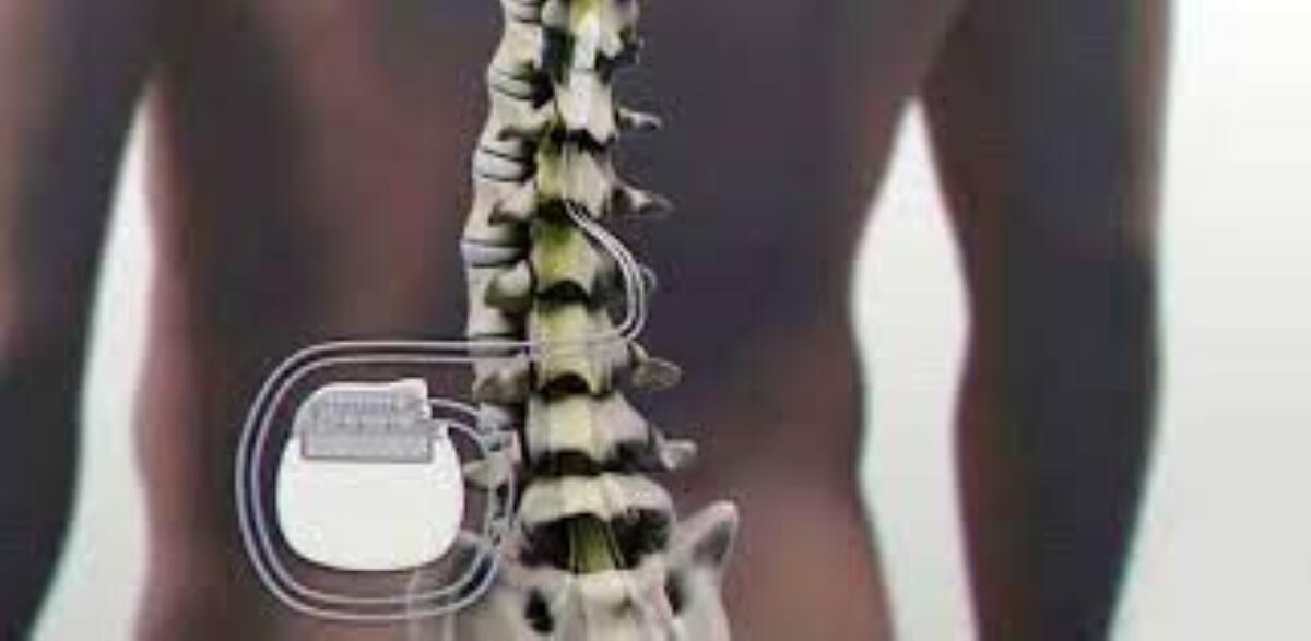 Dolore cronico nei pazienti diabetici, al Perrino di Brindisi arriva la stimolazione spinale: è la prima volta in Puglia Dolore cronico nei pazienti diabetici, al Perrino di Brindisi arriva la stimolazione spinale: è la prima volta in Puglia