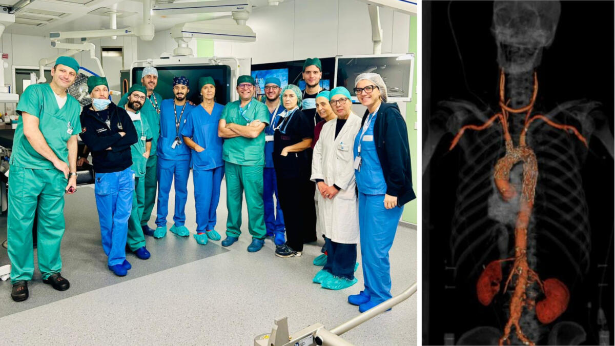 Bari, 80enne “non operabile” salvato al Policlinico con la sostituzione dell’arco aortico con procedura endovascolare Bari, 80enne “non operabile” salvato al Policlinico con la sostituzione dell’arco aortico con procedura endovascolare