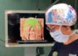 Bari, al Policlinico la tecnologia 3D ricostruisce il volto dopo un trauma: operata una donna di 51 anni