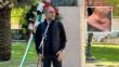 Foggia, l’assessore regionale Piemontese investito da un monopattino durante la cerimonia del 25 aprile