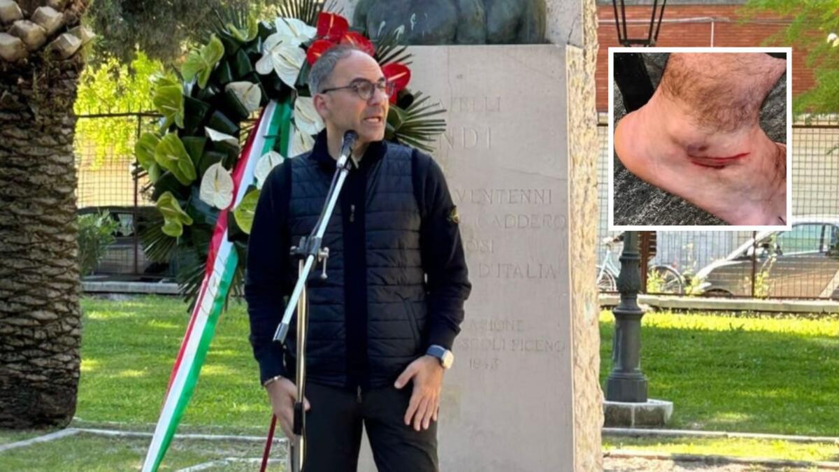 Galleria foto 'Foggia, l’assessore regionale Piemontese investito da un monopattino durante la cerimonia del 25 aprile' - foto 1