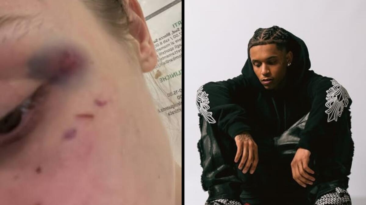 Aggredì l’ex fidanzata, rapper milanese condannato a 3 anni Aggredì l’ex fidanzata, rapper milanese condannato a 3 anni