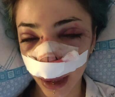Violenza al Parco Rossani di Bari. Abbaticchio: «Non è un fatto isolato, serve un patto educativo»