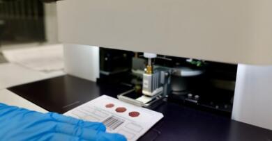Genoma-Puglia, con cellule staminali Vittoria salvata a soli 17 giorni di vita da immunodeficienza